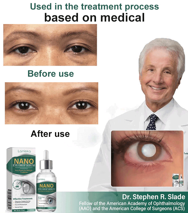 【Say Goodbye to Cataracts】Give You Clear Eyes