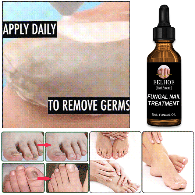 nail conditioner