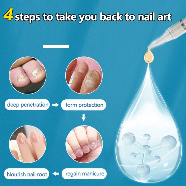 ⏰LAST DAY🔥BUY 1 GET 1 FREE🎁Nail repair pen