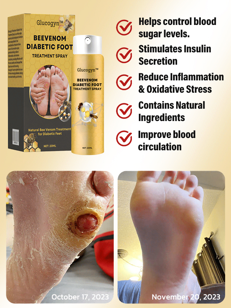 Diabetic foot treatment spray