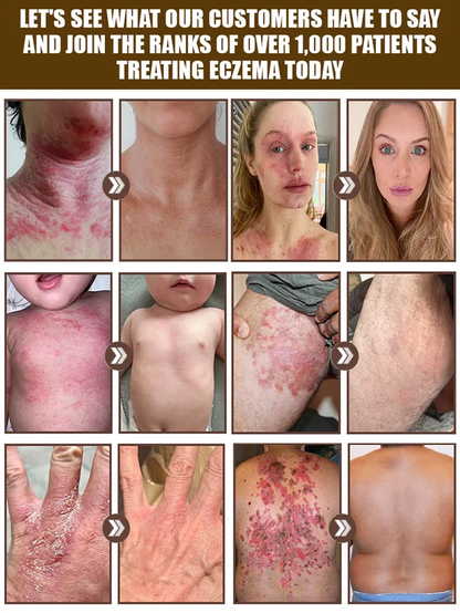 Bee Venom Skin Care Cream