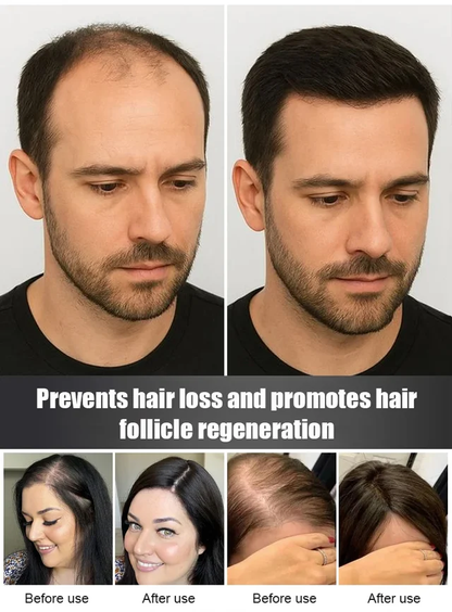 【Give you thick black hair in one month】Hair Growth and Blackening Spray