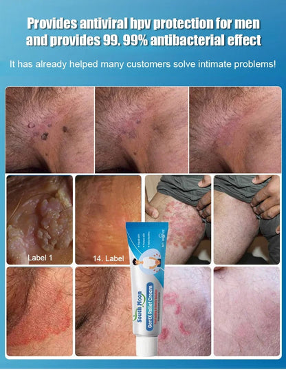 Men's Body Blemish Care Cream