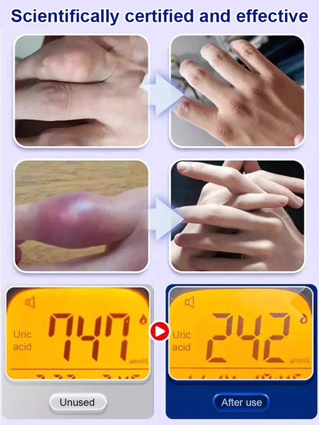 Uric Acid Excretion Joint Patch