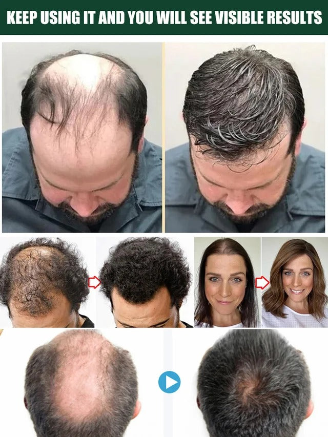 Hair Growth Essence Treatment Spray