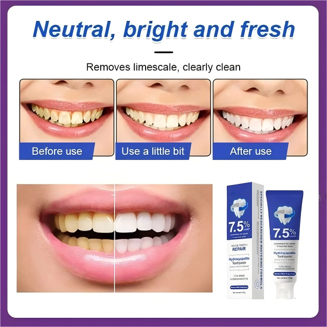 7.5% Nano-Hydroxyapatite Restorative Toothpaste