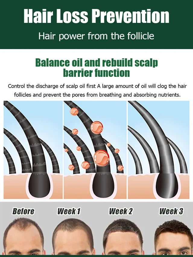 Hair Growth Essence Treatment Spray