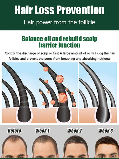 Hair Growth Essence Treatment Spray